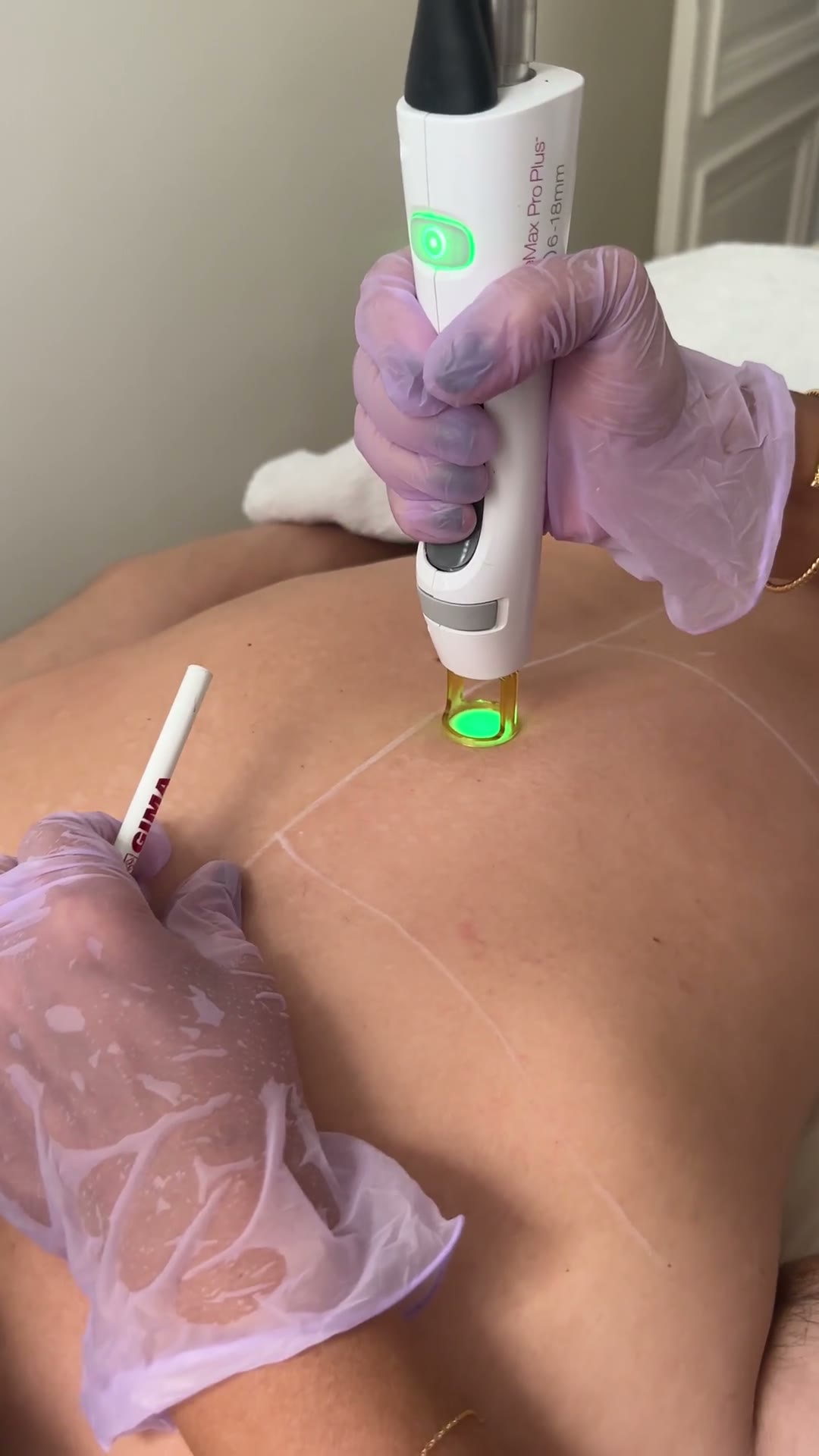 Épilation laser · Prestige Skin